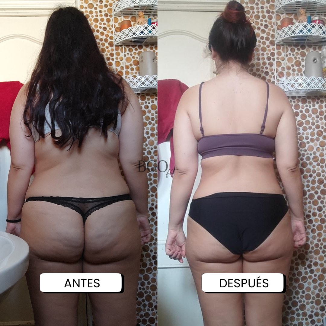Resultado antes y después