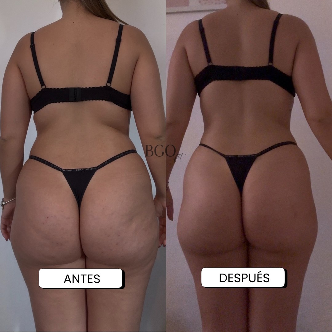 Resultado antes y después