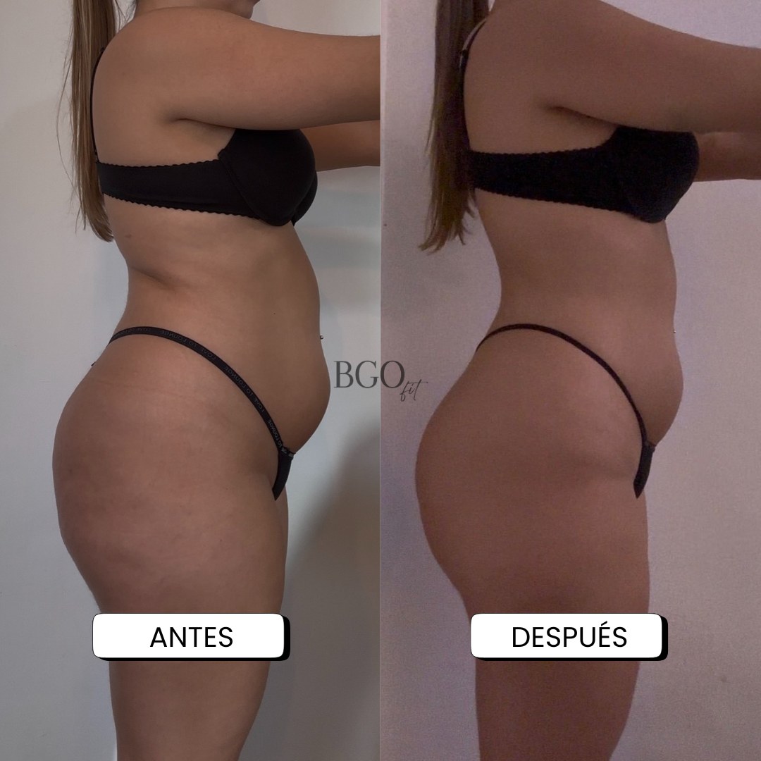 Resultado antes y después