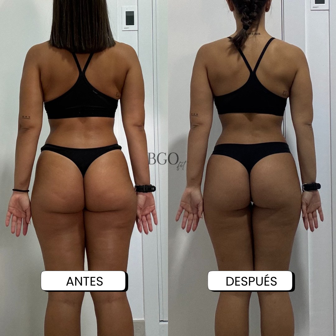 Resultado antes y después