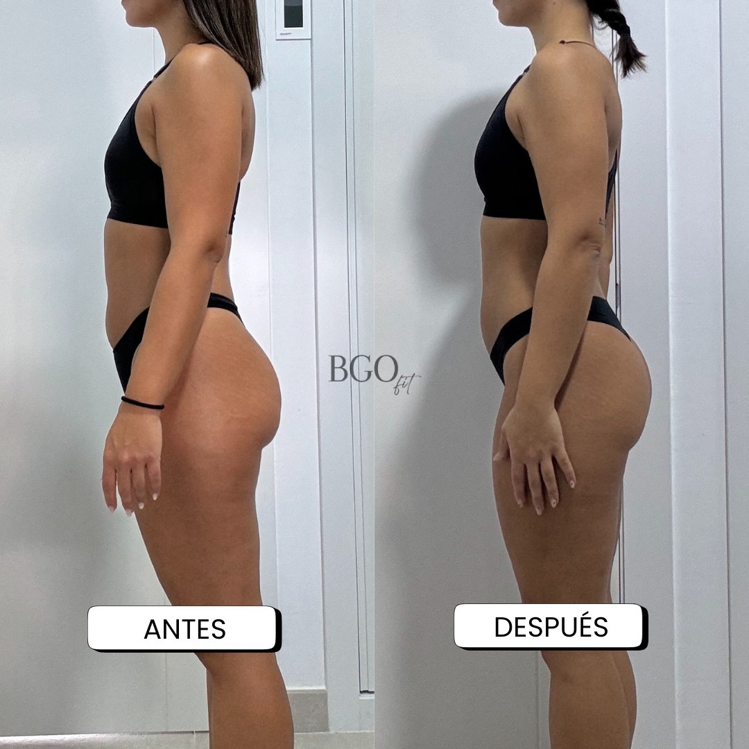 Resultado antes y después