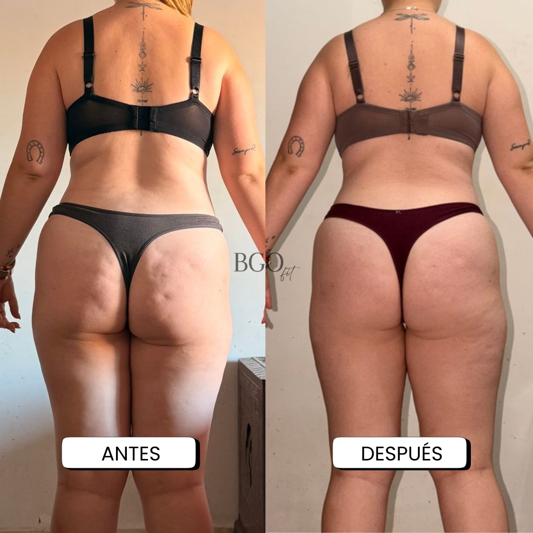 Resultado antes y después