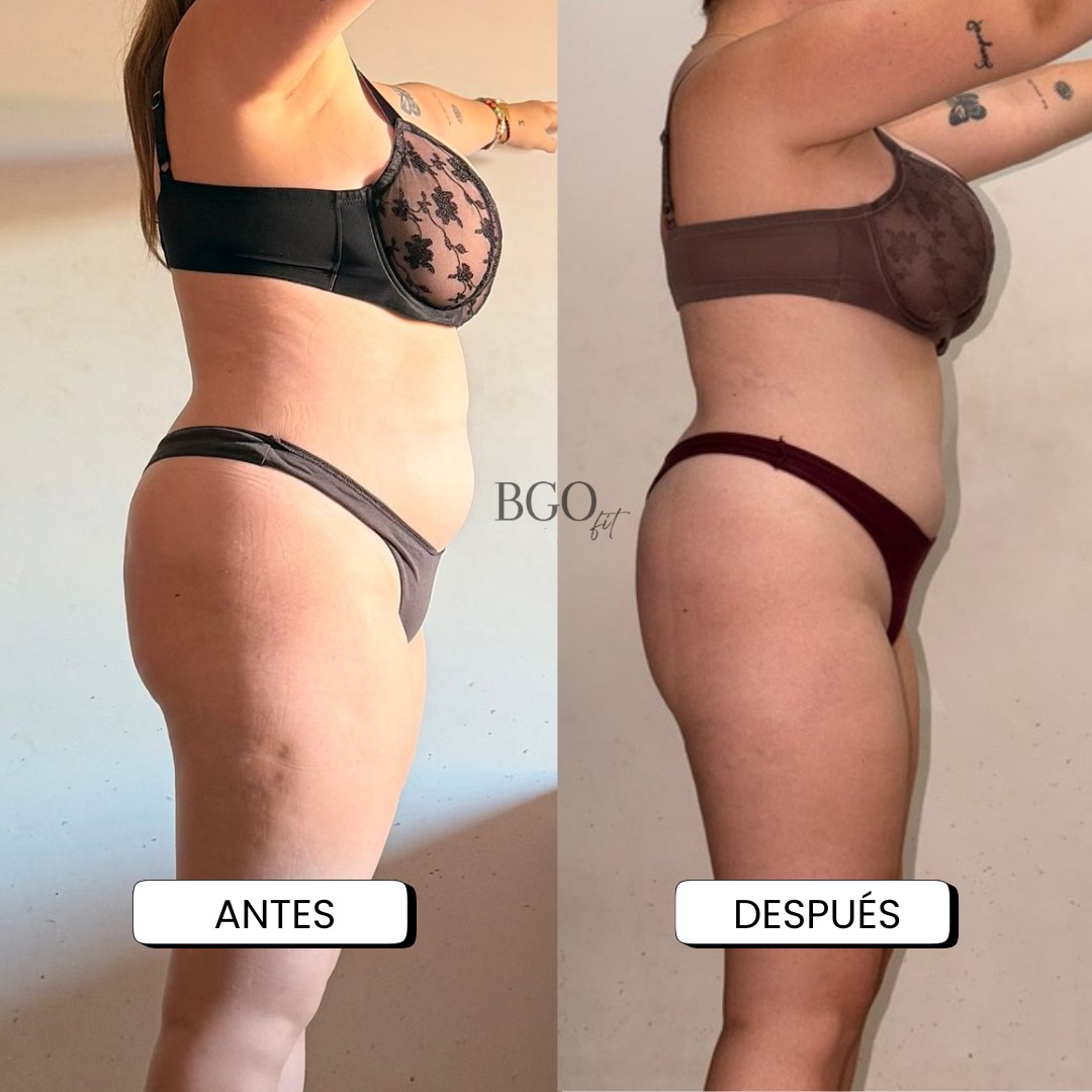 Resultado antes y después